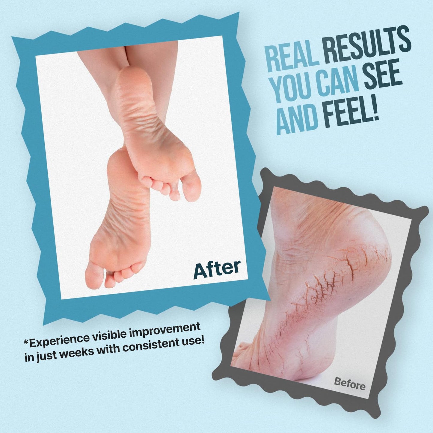 Urea Cream for Feet - Maximum Strength 42% Foot Cream for Calluses and Dry Feet - Free Pumice Stone and Brush - Shea and Mango Butters-Paraben Free-Fragrance Free- 4oz.