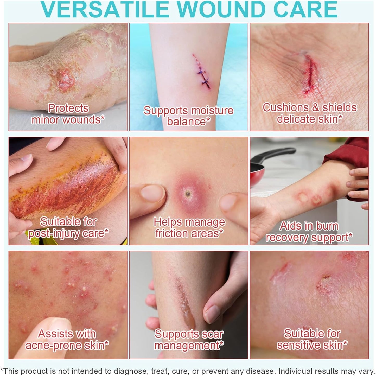 Hydrocolloid Roll for Wound Care, Extra Large Hydrocolloid Patch Bandages with Self-Adhesive, Hydrocolloid Tape, Ultra Absorbent, Flexible & Waterproof DIY Size & Shape(2in*11.8ft)