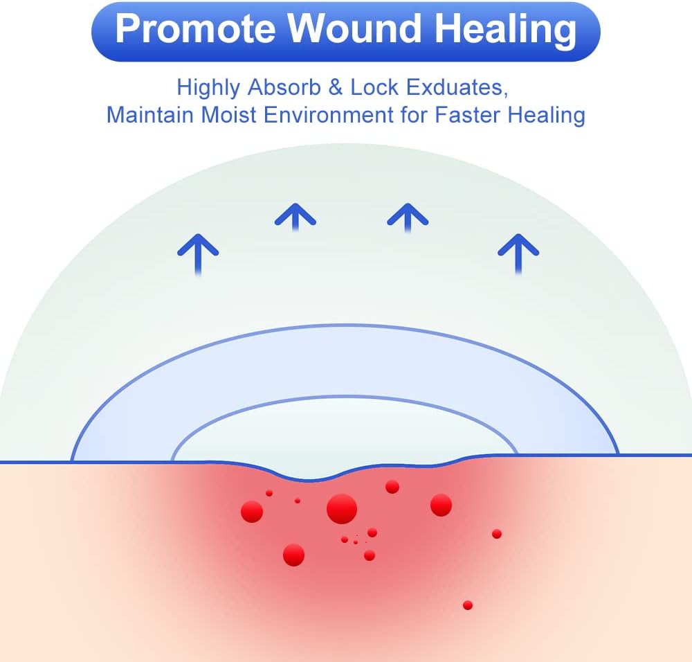 10 Count Hydrocolloid Bandages Large, 2" x 4" Hydrocolloid Wound Dressing Extra Thin for Light Exudate, Hydrocolloid Gel Bandages Fast Healing