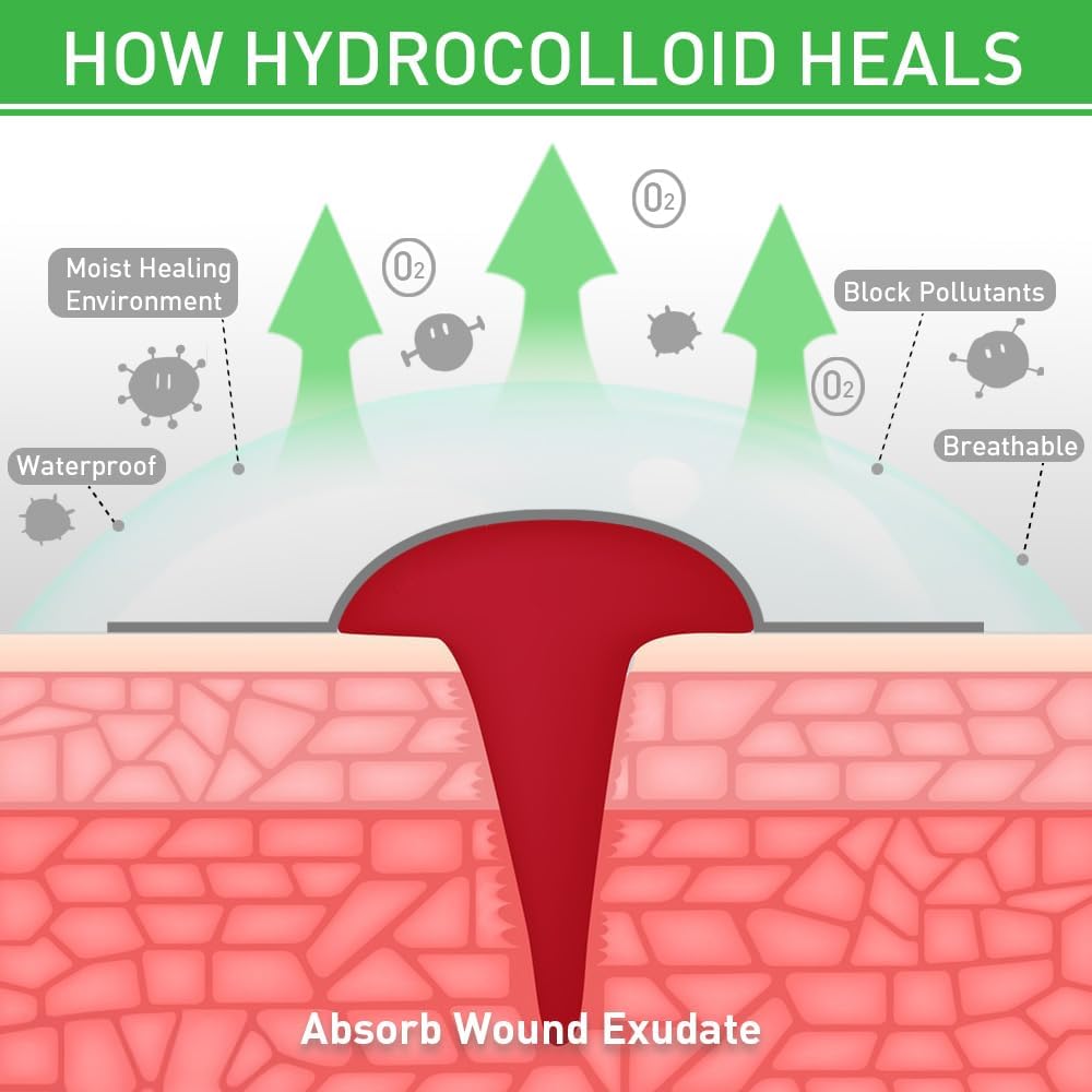 2in*16ft Hydrocolloid Roll for Wound Care,Large Hydrocolloid Bandages Patch with Self-Adhesive Waterproof Ultra Absorbent Flexible DIY Size & Shape First Aid Kit Essential