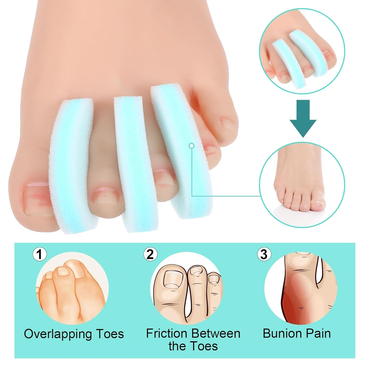 20Pack Foam Toe Separator, Breathable Toe Spacers for Women Men, Toe Spreader to Reduce Friction and Relieves Corns Pain, Relieve Pain Caused by Bunions