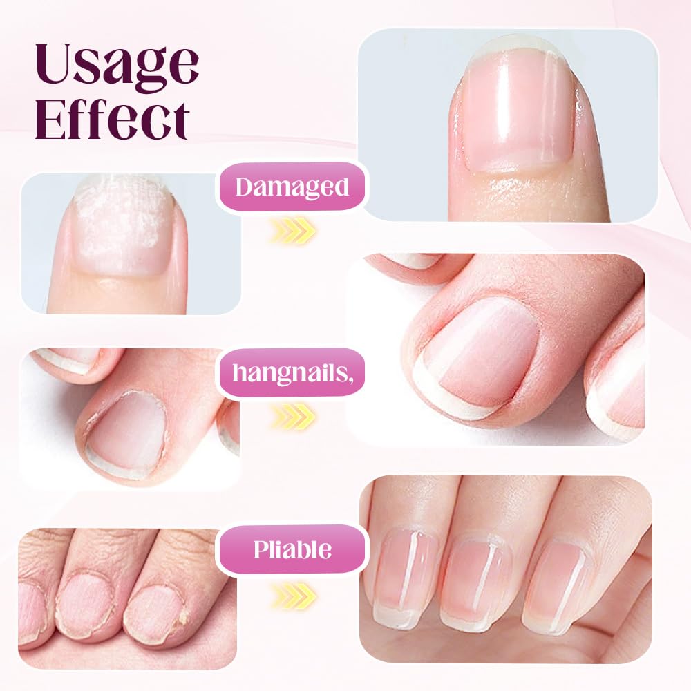 Upgrade 3-in-1 Nail Care Pen, 2025 Cuticle Pusher with Ceramic Tip for Hangnails, Dry & Damaged Nails, Nail Cuticle Remover Pens, for Moisturize Strengthen Nails (2 PCS)