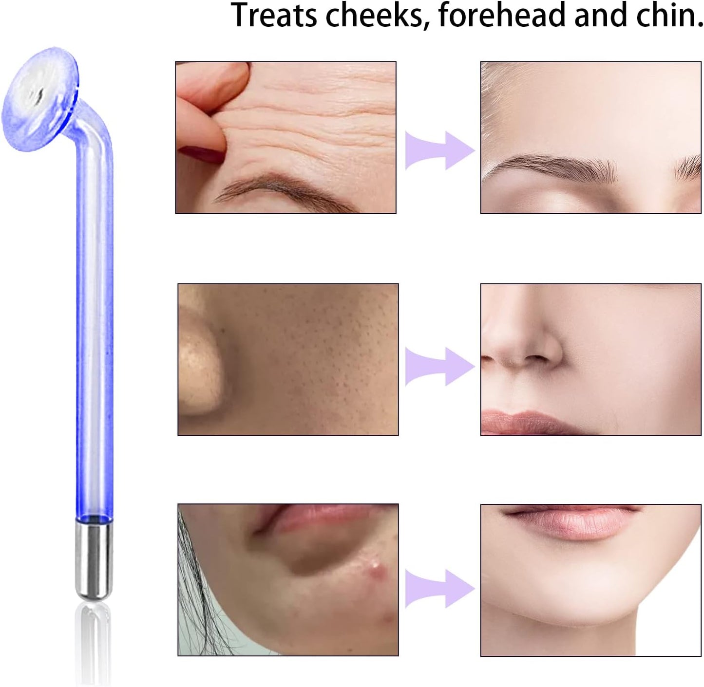 Electrode Wand Glass Tube Handheld Spare Parts Elitzia ETJX006AS (Mushroom Blue)