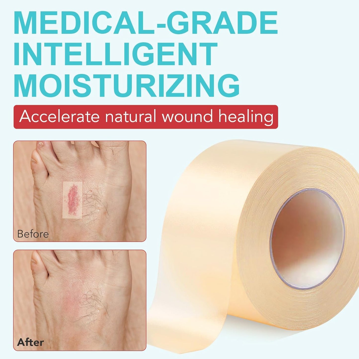 Hydrocolloid Roll for Wound Care, Cut-to-Size, Hydrocolloid Patch Bandages with Self-Adhesive, Ultra Absorbent, Waterproof, Home Essential, 2in x 11.8ft