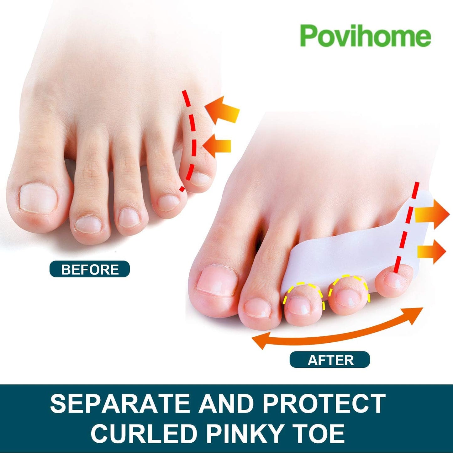 Povihome 10 Pack Pinky Toe Separator and Protectors, Triple Gel Toe Separators for Overlapping Toe, Curled Pinky Toes Separate and Protect