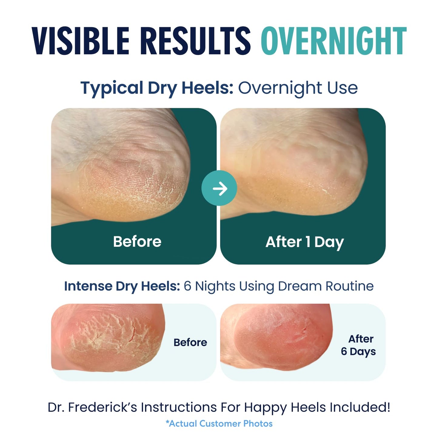 Dr. Frederick's Original Moisturizing Heel Socks for Cracked Heel Treatment - 2 Pairs - Socks for Dry Feet - Cracked Skin Repair & Overnight Hydration - Foot Care for Women & Men - Green Aloe