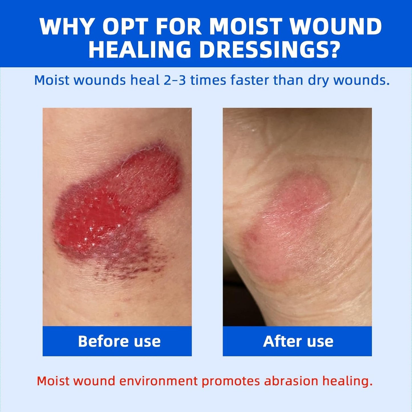 10 Count Hydrocolloid Bandages Ultra Thin 4"x4" - Hydrocolloid Gel Bandages Designed to Fit Joints, Wound Dressing for Abrasions, Blisters, Minor Exuding Wounds, Waterproof & Flexible