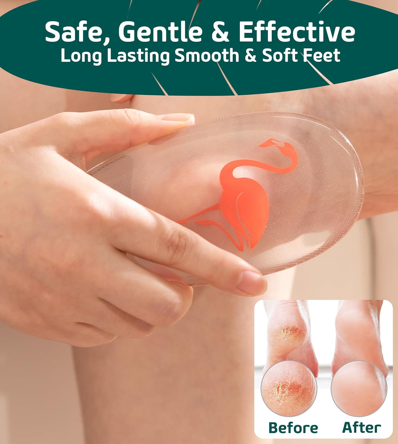 Glass Foot File Callus Remover for Feet, Flamingo Gifts for Women, Feet Scrubber Dead Skin Remover, Professional Pedicure Tools at Home, Heel Scraper for Cracked Heels Heavy Duty