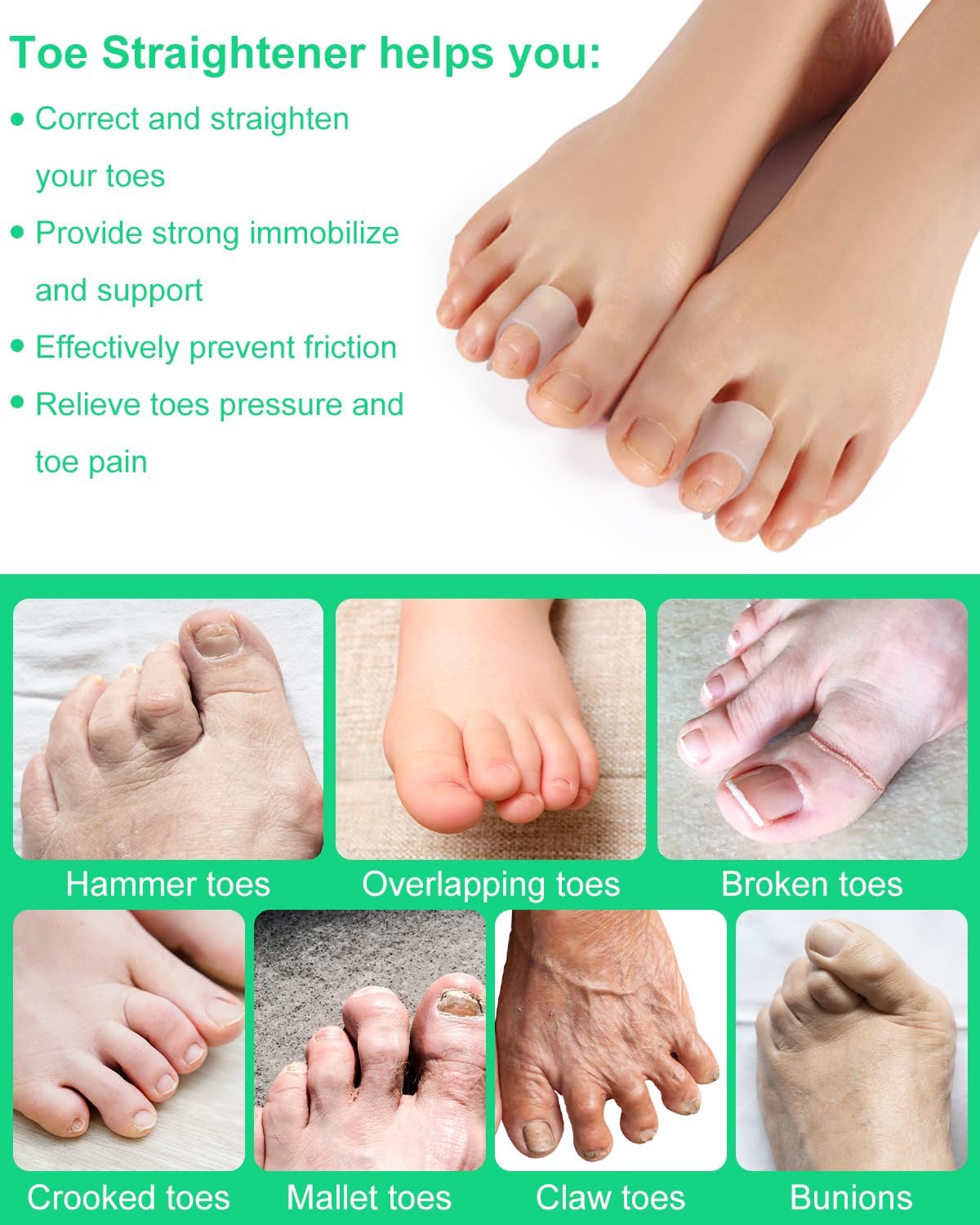 12Pcs Hammer Toe Corrector Straighteners for Women and Men Curled Toes, Crooked, Claw, Hammertoe, Gel Toe Splints Bunion Spacer Separators for Straightening (Multi-size)