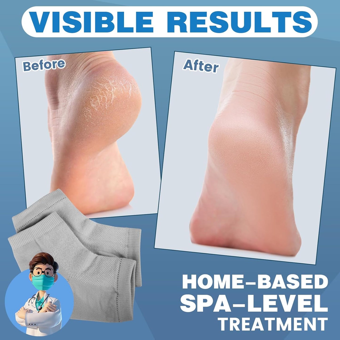 Moisturizing Toeless Socks for Cracked Heels - Heel Repair, Hydrate Dry Feet