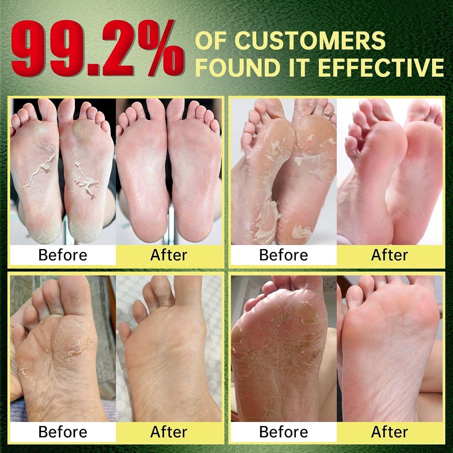 Foot Peeling Mask, Natural Exfoliating Foot Mask, Dead Skin Callus Remover Repair Heels, Hydrating Foot Care for Dry Cracked Feet (9 Pack)