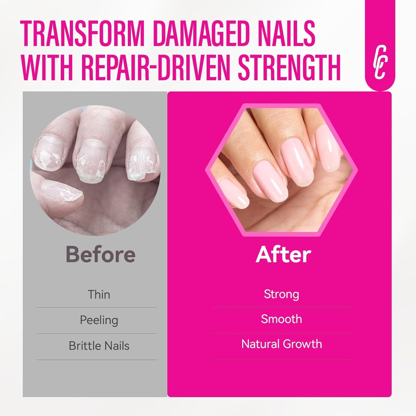 Nail Repair for Women: 8 in 1 Pink Nail Hardener Extra Strong and Growth - 15ML Natural Nail Polish Hardener Ridge Filler Strengthener for Weak and Damaged Nails 15ml
