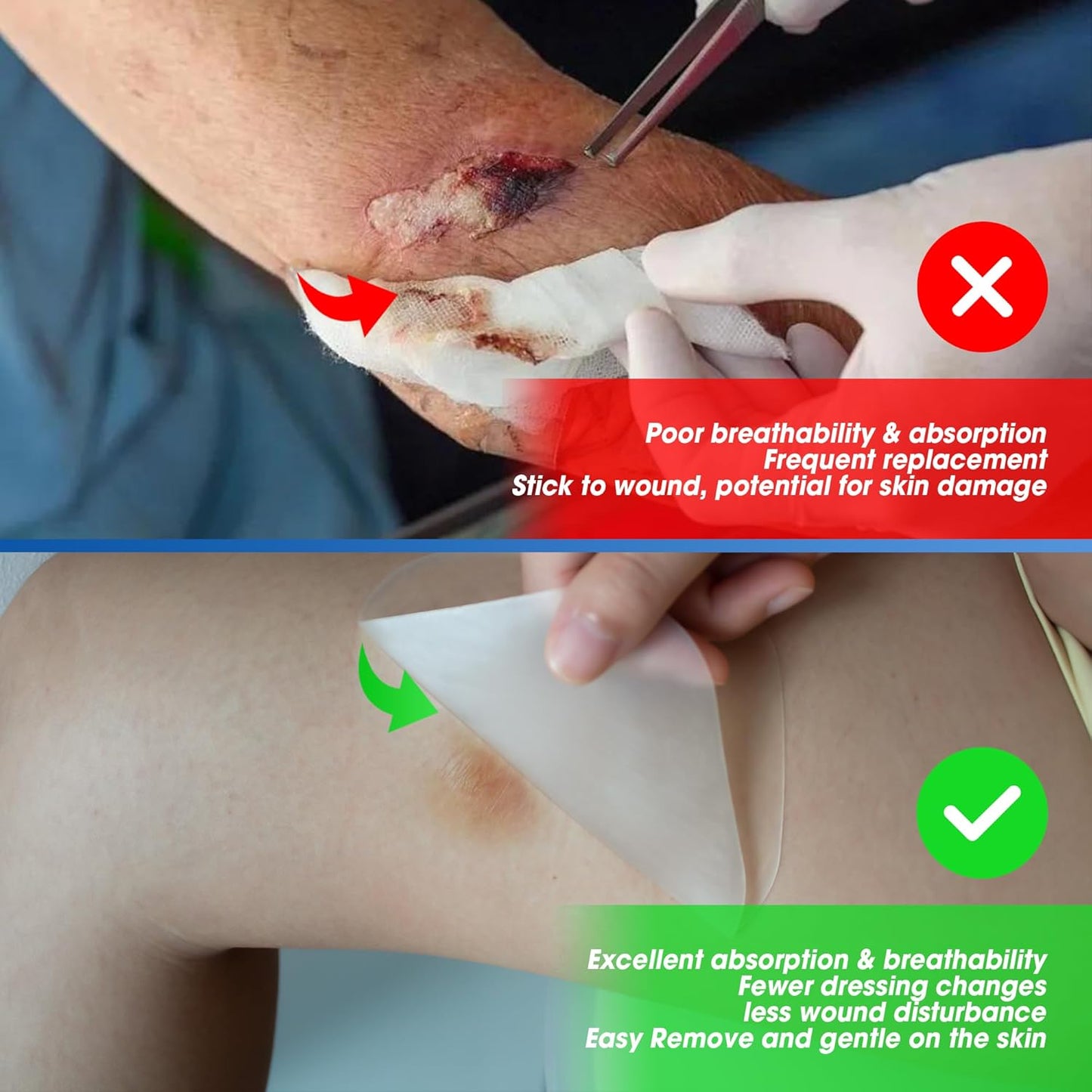 Hydrocolloid Bandages 2" x 2", Waterproof Dressing with Self-Adhesive for Light Exudate Wound, Blister, Acne, Bordered Hydrocolloid Patches for Bed Sores, Abrasions, 20 Pack