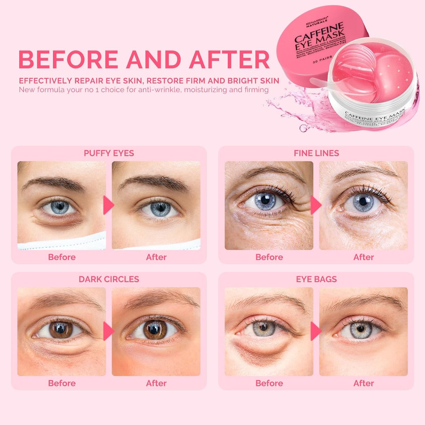 Enaskin Naturals Brightening Eye Masks: 30 Pairs Caffeine Under Eye Patches for Dark Circles and Puffiness w/Hyaluronic Acid - Skin Treatment Pads For Face Reduce Wrinkles & Bags (Rose)