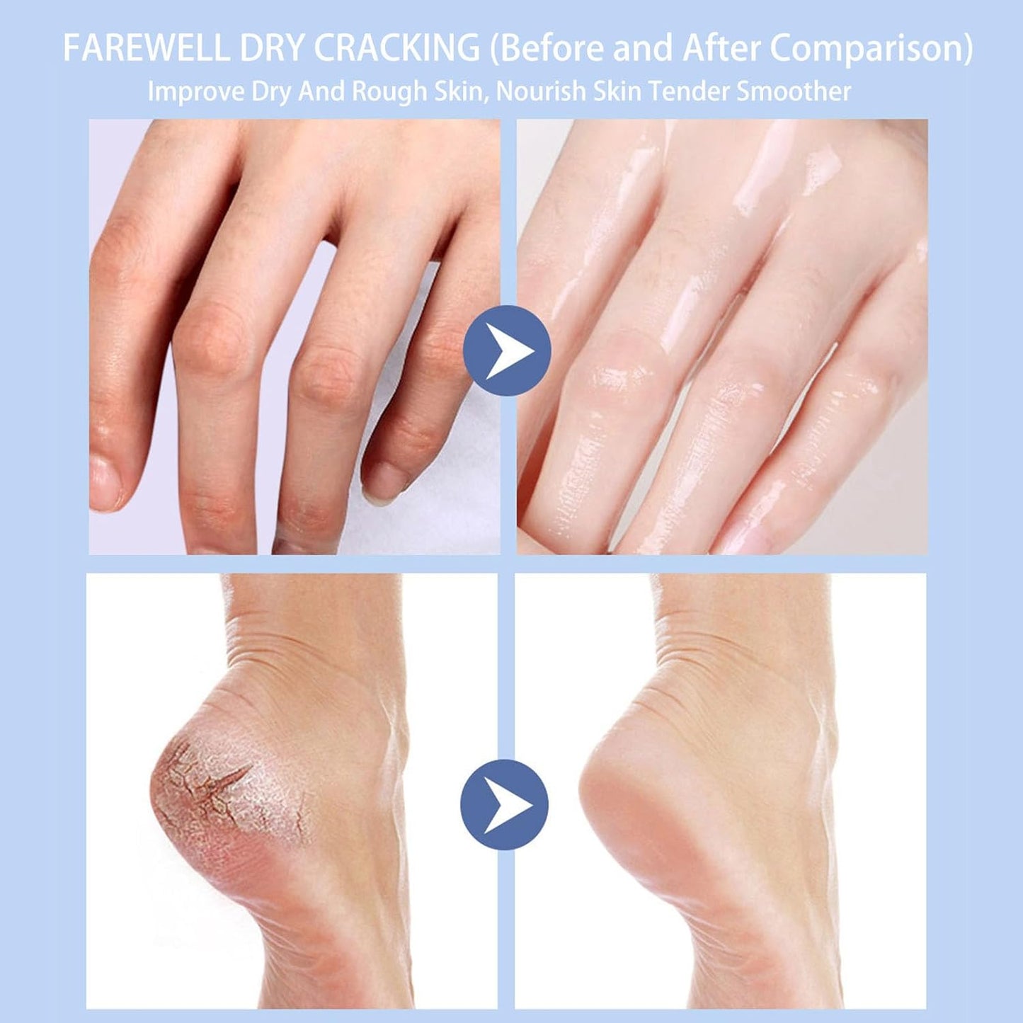 Crack Feet Prevention Stick 2PCS - Foot Care Cream Heel Balm for Dry Cracked Feet, Remove Dead Skin and Moisturize Dry Skin for Face, Knees, Elbows, Hands (2pcs, Orange + Banana)