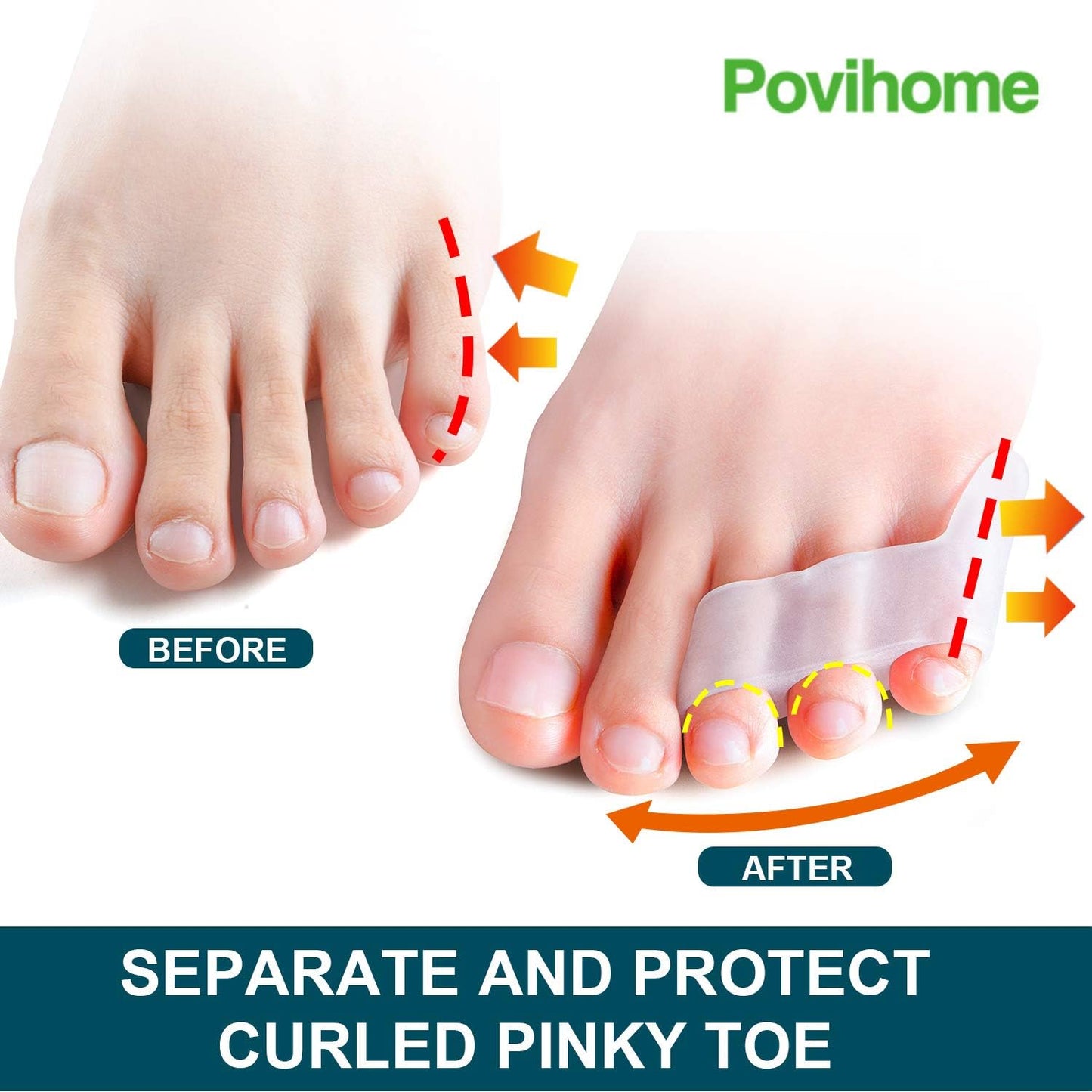 Povihome 10 Pack Pinky Toe Separator and Protectors, Triple Gel Toe Separators for Overlapping Toe, Curled Pinky Toes Separate and Protect
