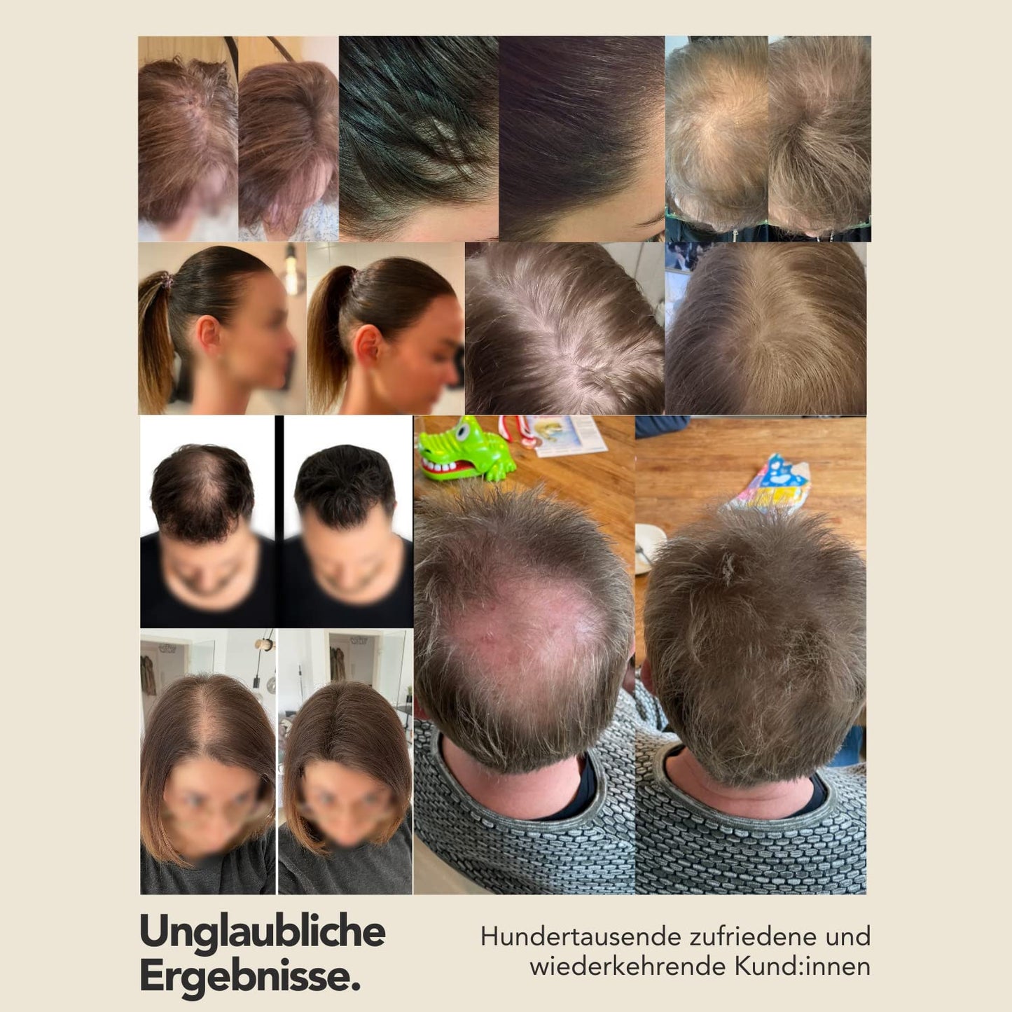 IMPERIO Hair Building Fibers for Thinning Hair - 26g Premium Hair Fibers for Women & Men in Hairdresser Quality - Hair thickening in less than 20 seconds (Medium Blonde)