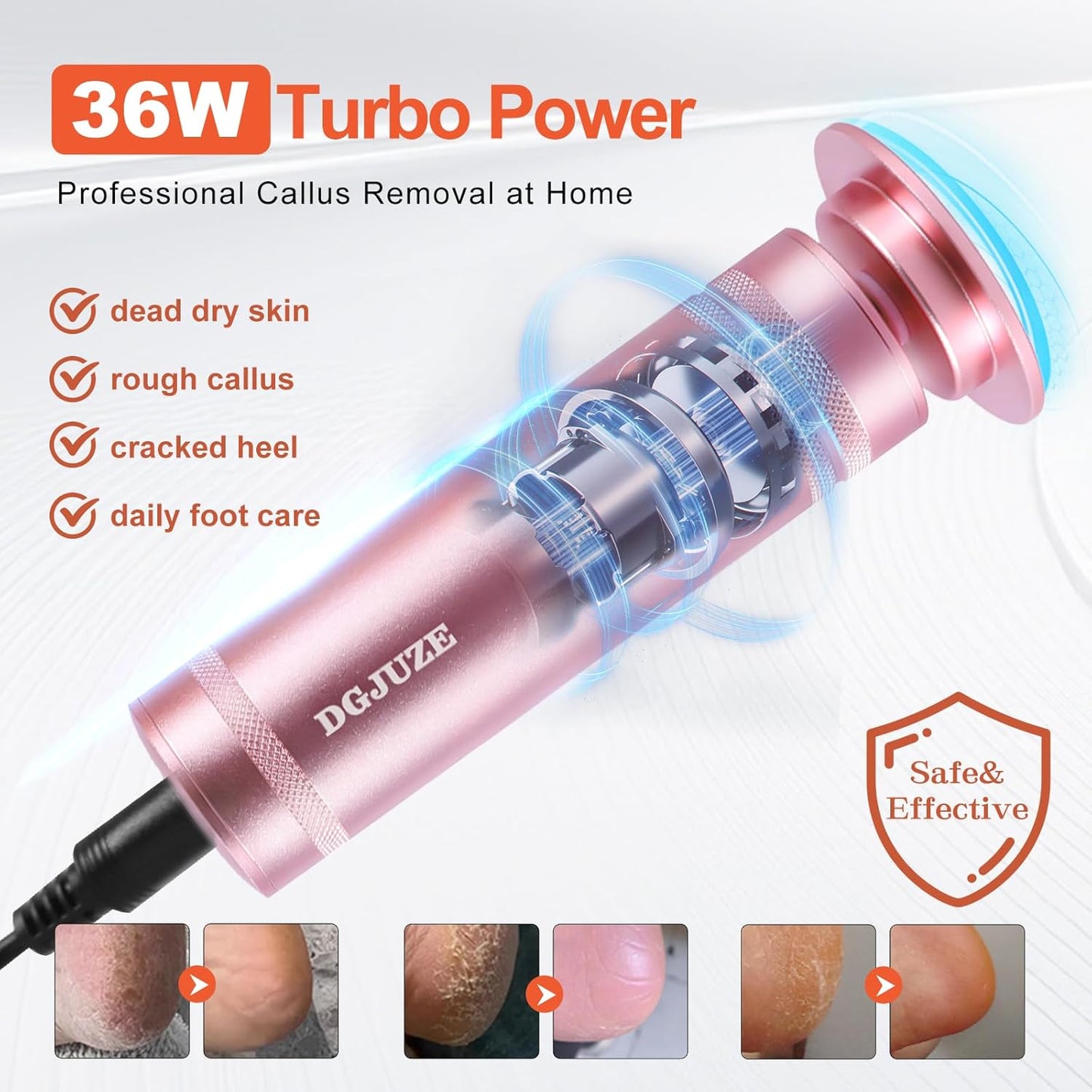 PowerPro Electric Foot Callus Remover 36W Professional 1200rpm Adjustable Speed Metal Feet Grinder Automatic Heel Sander with 60pcs Replacement Sandpaper Discs for Home Use (Pink)