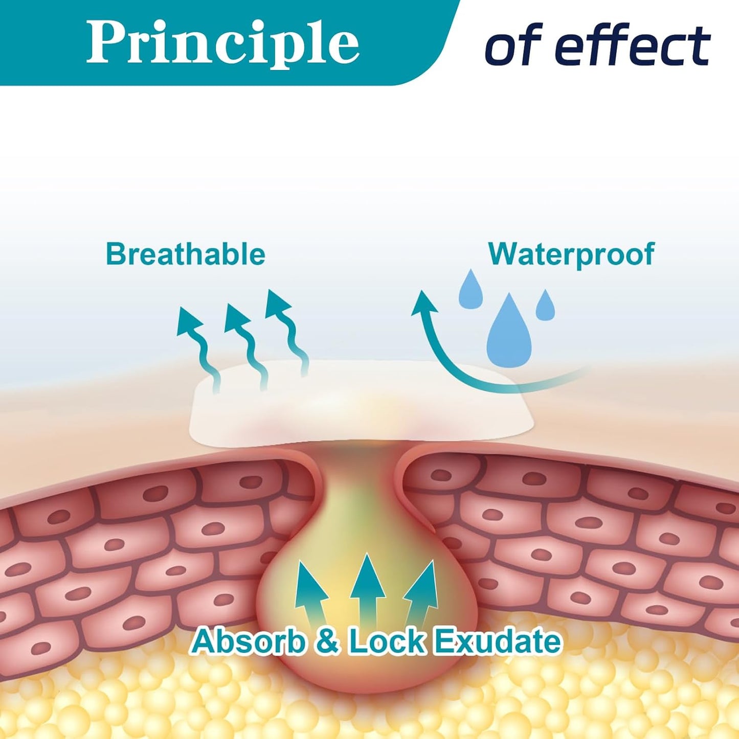 20 Pack Hydrocolloid Wound Dressing, 2" x 2" Ultra Thin Hydrocolloid Bandages with Self-Adhesive, Waterproof Hydrocolloid Patch for Bed Sore, Mild Burn, Blister, Acne Care