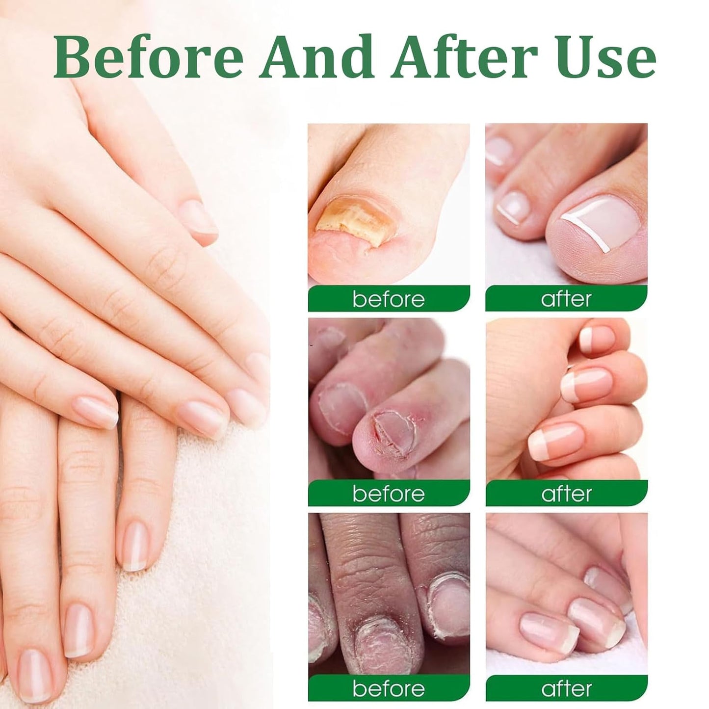 Nutraboost Nail Treatment Gel, Nail Growth Serum for Repair & Strengthener, Multi-Purpose Nail Repair Serum (2)