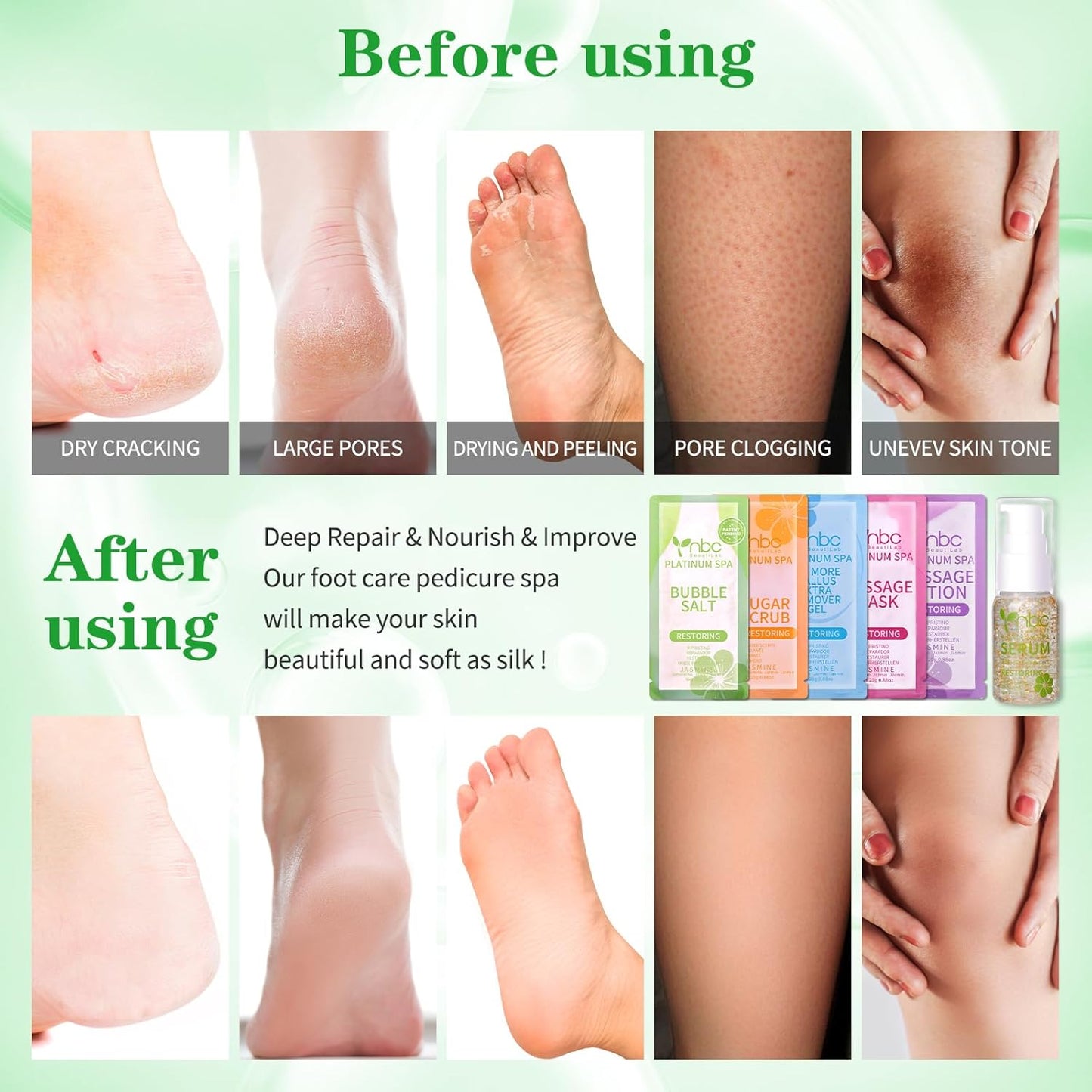 Pedicure Foot Soak Set - Upgraded 6 in 1 Foot Spa, Foot Bath Spa, Pedicure Kit, Foot Soak for Tired & Dry Cracked Feet, Athletes Feet, Bad Odor, Softens Calluses (Jasmine)