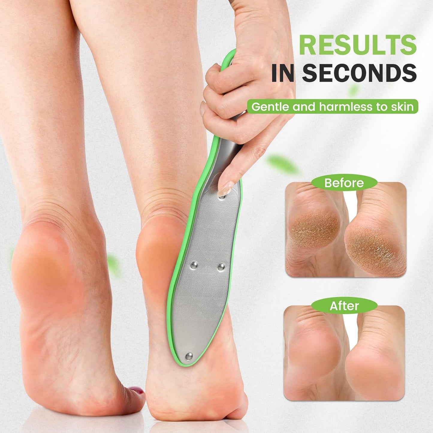 BEZOX Foot Scrubber for Dead Skin(1PCS) - Double Sided Feet File Callus Remover, Heavy Duty Stainless Steel Heel Scraper, Cracked Heel Repair - Green
