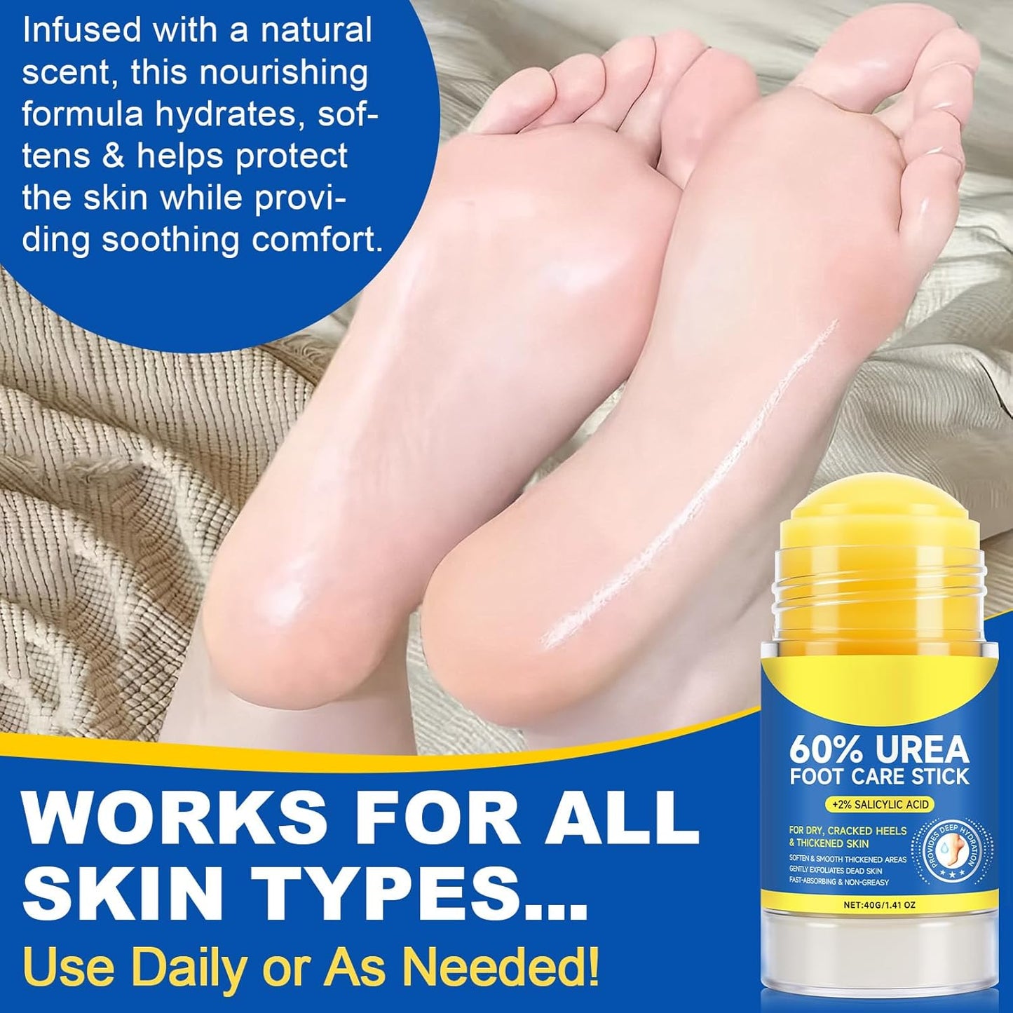 Urea Cream Stick 60% plus 2% Salicylic Acid,urea cream percent for feet maximum strength,Foot Lotion Stick for Cracked Heels,Dry Hands & Rough Knees,Callus Remover & Skin Softener, Soften Dead (1)