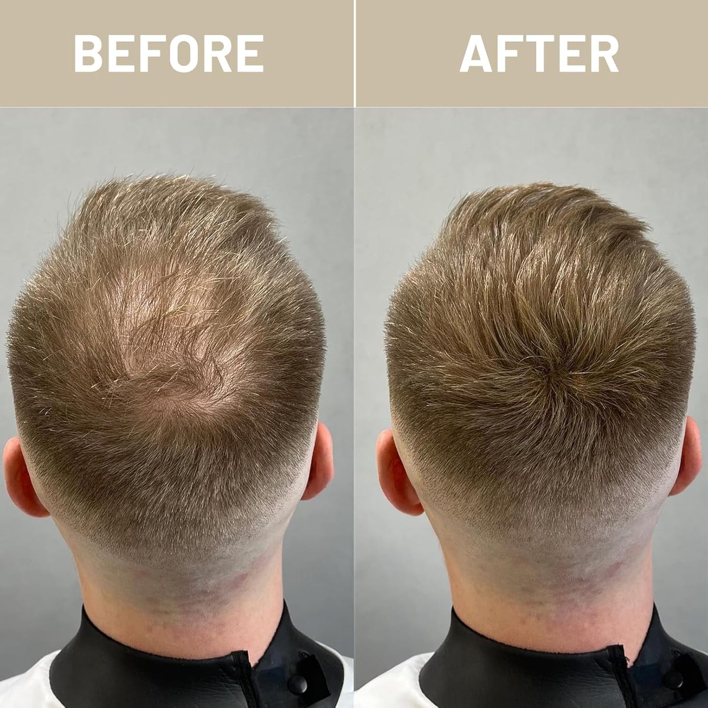 VOLLUCK Hair Fibers for Thinning Hair, Instant Coverage Hair Building Fibers for Women and men, Natural Hair Powder for Conceal Hair Loss 28 g (Medium Blonde)