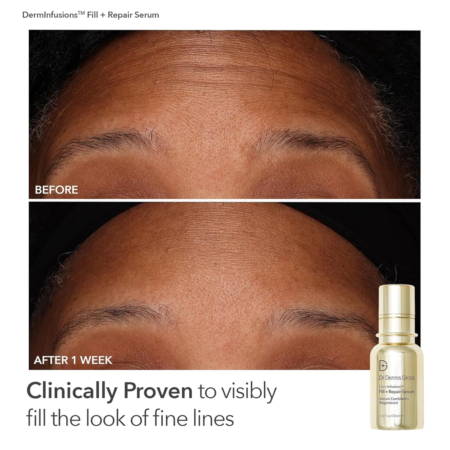 Dr. Dennis Gross Fill, Plump & Firm Kit – DermInfusions™ Hyaluronic Acid Serum, Eye Cream & Lip Treatment | Boost Hydration, Smooth Fine Lines & Enhance Volume | Limited Edition Gift Set