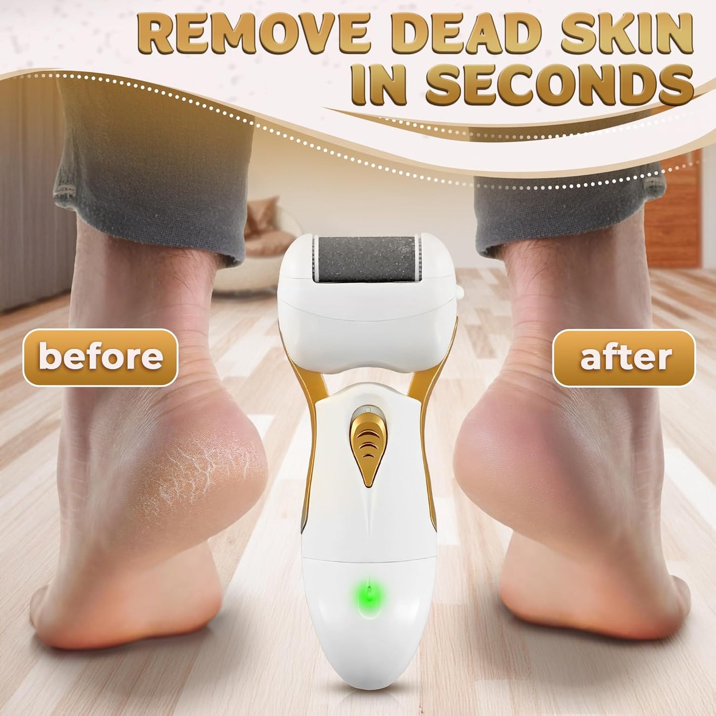 Electric Callus Remover for Feet – 5W Electric Foot Filer, 90-Min Runtime Foot Sander with Fast 2H Charge & 3 Replacement Rollers – Hard Skin Remover for Feet with Ergonomic Handle for Easy Grip